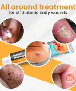 Histone™ Diabetic Wounds Treatment Cream