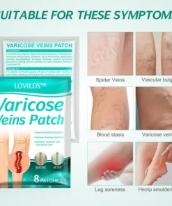 LOVILDS™ Leech Varicose Veins Patch