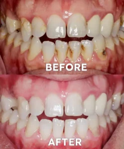 Ourlyard™ Teeth Restoration Mineral Powder