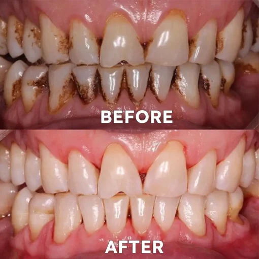 Ourlyard™ Teeth Restoration Mineral Powder