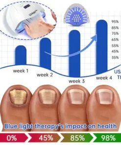 QIAWI™ PureNail Fungus Laser Device