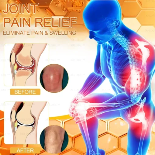 Raindew™ TurmericFix - Natural Turmeric Joint Repair Pads for Arthritis & Pain Relief