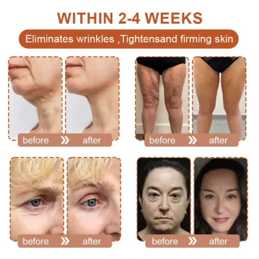 Flysmus™ BotoxBee Wrinkle Removal Cream