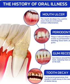 Furzero™ EaseSmile Gums Therapy & Pain Relief Probiotics Bee Venom Chicles