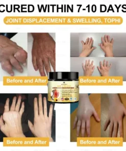 LOVILDS™Bees Pain Relief Bone Healing Cream 👨‍⚕️ American Osteopathic Association