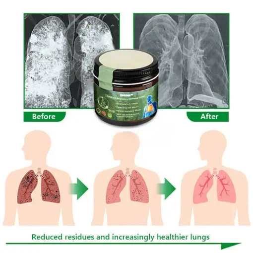 Raindew™ Mullein Clear Lung Repair Cream