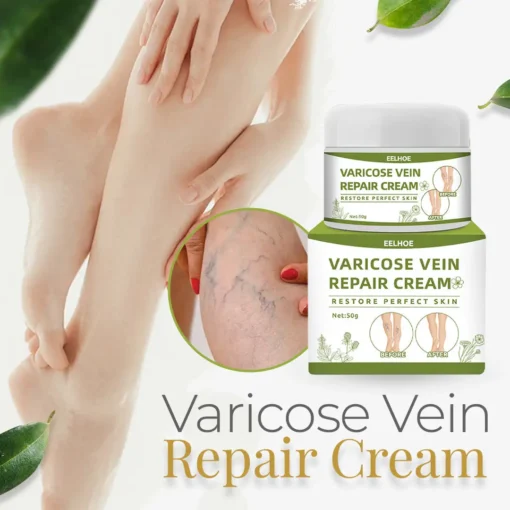 Varicose™ Vein Repair Cream (Point AAD Recommended) for Varicose Vein Removal, Spider Veins